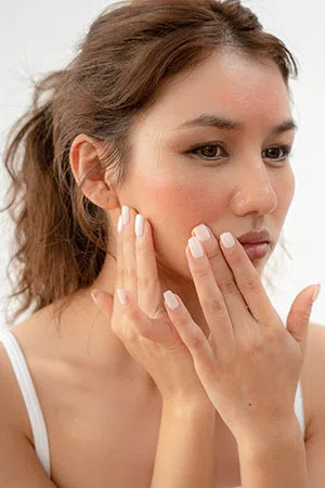 Sensitive Skin