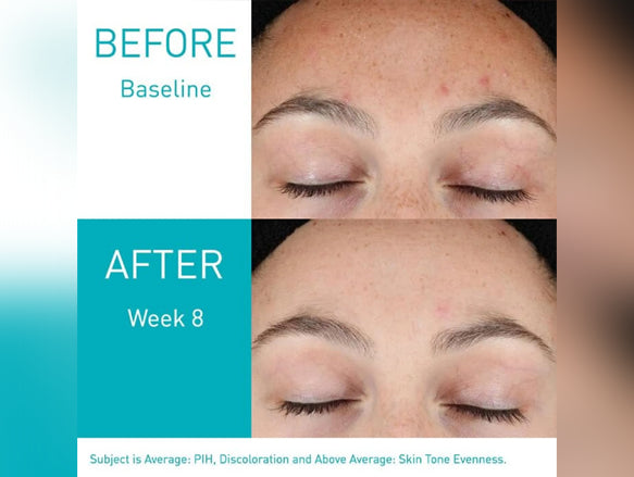 Cerave Resurfacing Retinol Serum 30ml - USA in Sri Lanka