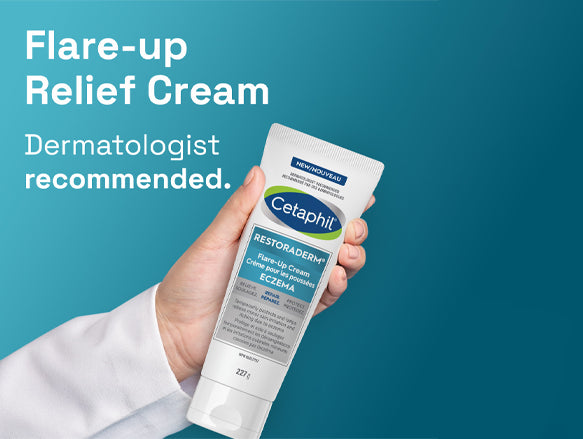 Cetaphil Restoraderm Flare-Up Eczema Cream 227g in Sri Lanka