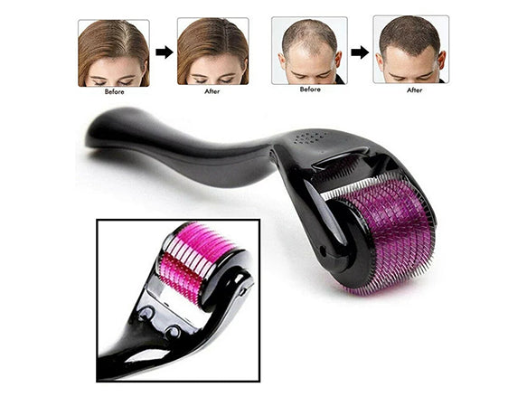 Derma Roller System with 540 Micro Needles - CHINA in Sri Lanka