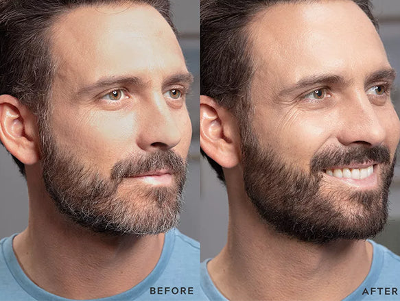 Just For Men Beard and Brow Colour Darkest Brown/Black 9ml - FRANCE in Sri Lanka