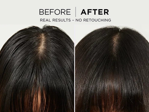 Loreal Hyaluron Pure 72H Purifying Salicylic and Hyaluronic Acid Shampoo 200ml