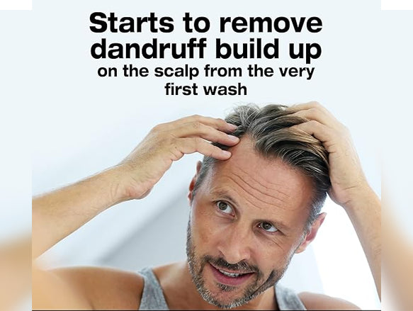 Neutrogena T/Gel Anti-Dandruff Shampoo For Dry Hair 150ml - GREECE - 3574661619552 in Sri Lanka