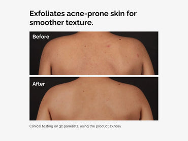 The Ordinary Salicylic Acid 0.5% Body Serum 240ml in Sri Lanka