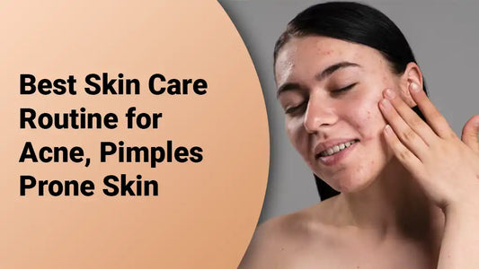 Best Skin Care Routine for Acne, Pimples Prone Skin