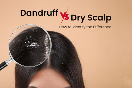 Dandruff vs Dry Scalp: How to Identify the Difference