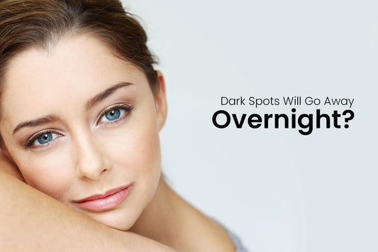Dark Spots Will Go Away Overnight? Myth vs Reality