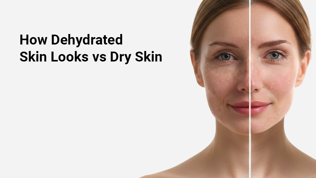 How Dehydrated Skin Looks vs Dry Skin