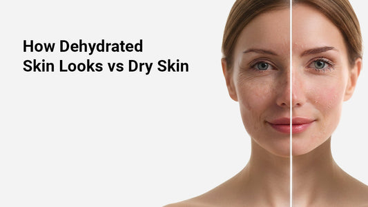 How Dehydrated Skin Looks vs Dry Skin
