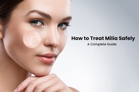 How to Treat Milia Safely: A Complete Guide
