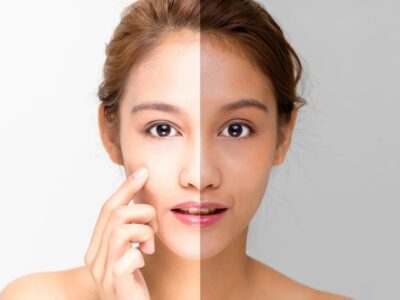 Best Whitening Cream in Sri Lanka