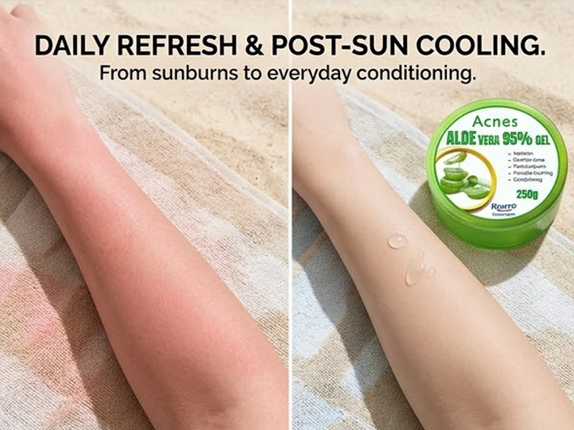 Acnes Aloe Vera 95% Gel in Sri Lanka