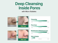 Some By Mi Bye Bye Blackhead 30 Days Miracle Green Tea Tox Bubble Cleanser 120g in Sri Lanka