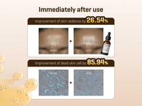 Some By Me Galactomyces Pure Vitamin C Glow Serum 30ml
