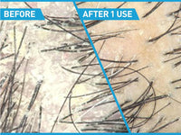 Cerave Anti-Dandruff Hydrating Shampoo 355ml in Sri Lanka