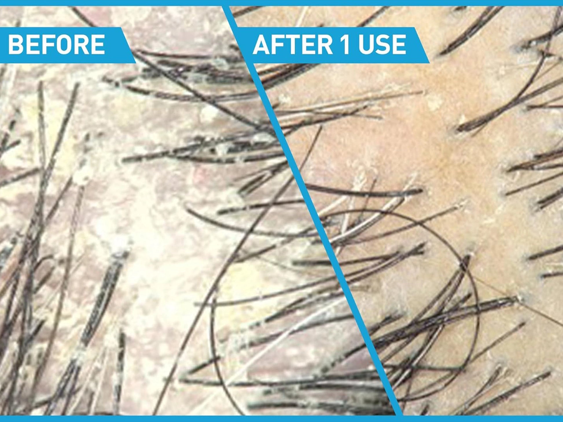 Cerave Anti-Dandruff 2 in 1 Shampoo and Conditioner 355ml in Sri Lanka