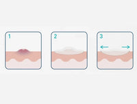 Cerave Imperfection Control Patches 22 Pcs in Sri Lanka