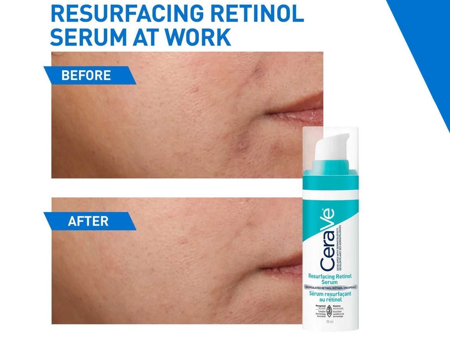 Cerave Resurfacing Retinol Serum 30ml in Sri Lanka 