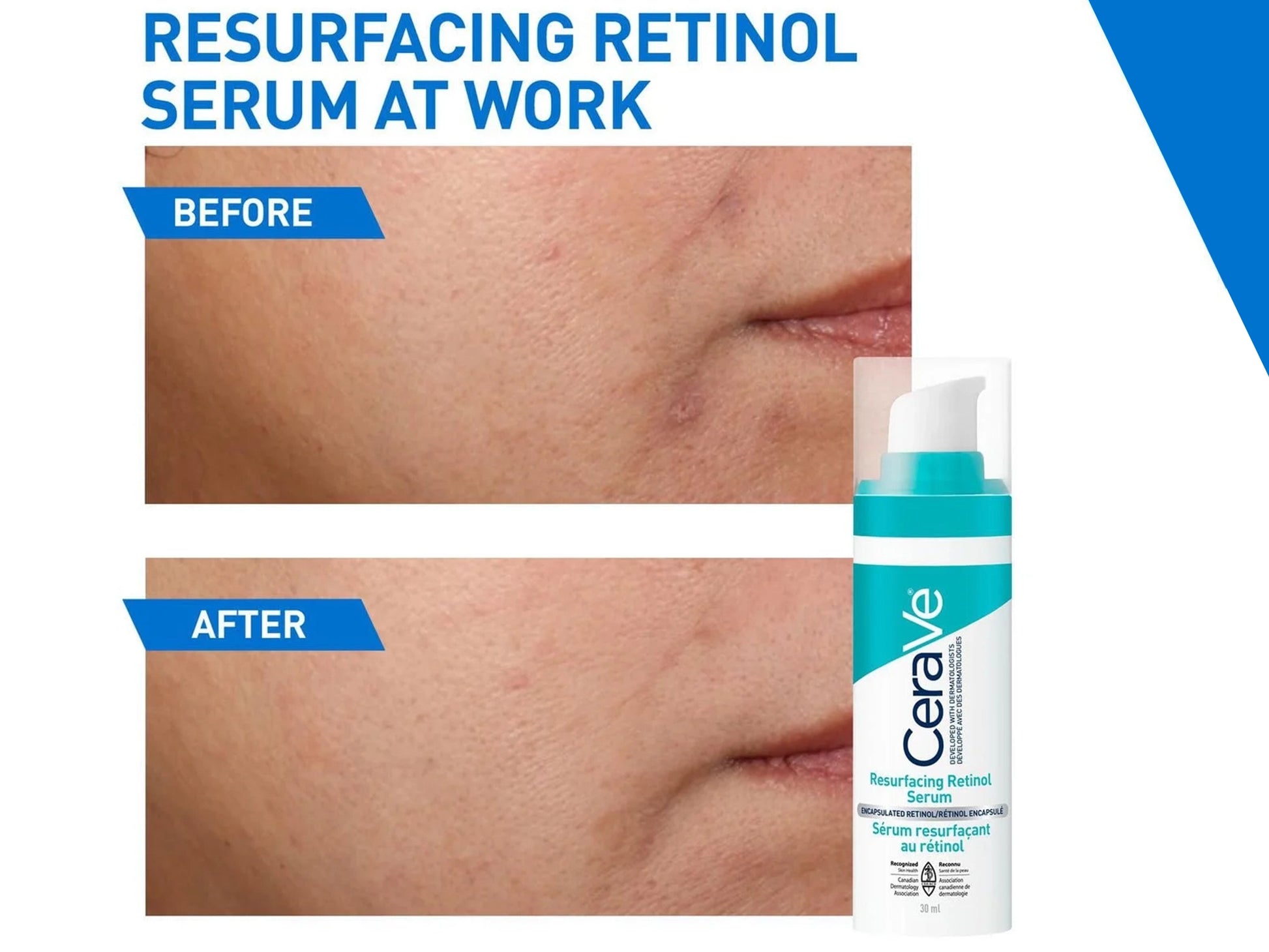 Cerave Resurfacing Retinol Serum 30ml in Sri Lanka 