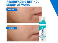 Cerave Resurfacing Retinol Serum 30ml in Sri Lanka 