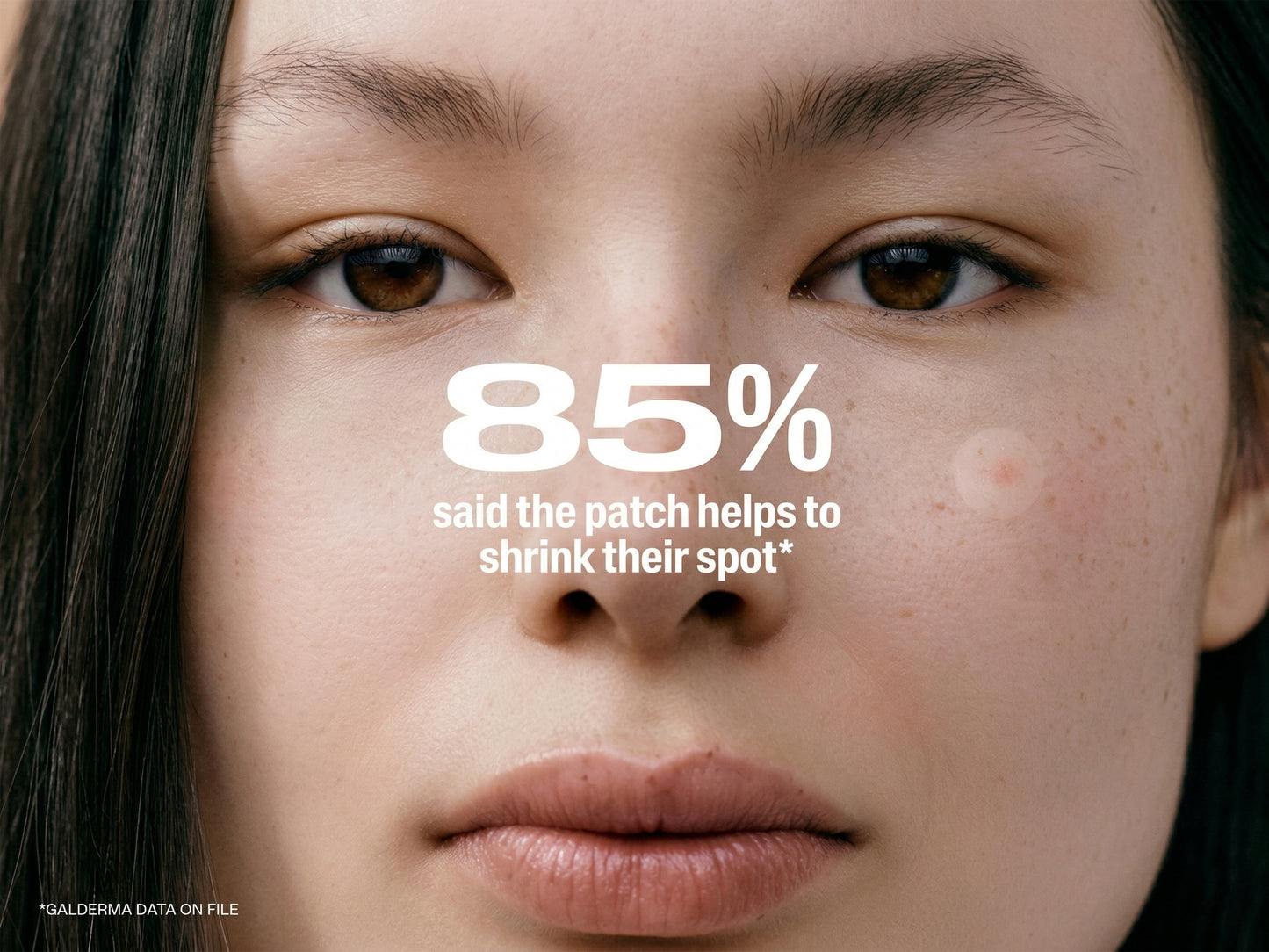 Cetaphil Fast Rescue Pimple Patch in Sri Lanka