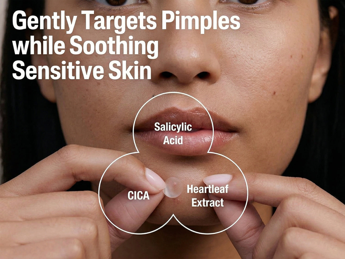 Cetaphil Fast Rescue Pimple Patch in Sri Lanka
