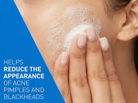 Cerave Acne Control Cleanser 473ml - USA in Sri Lanka