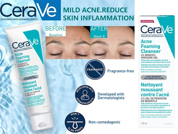 CeraVe Acne Foaming Cream Cleanser 150ml - USA in Sri Lanka 