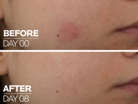 La Roche Posay Cicaplast B5 Ultra Repair Serum 30ml in Sri Lanka