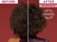 Loreal Elvive Fall Resist with Aminexil Conditioner 360ml in Sri Lanka