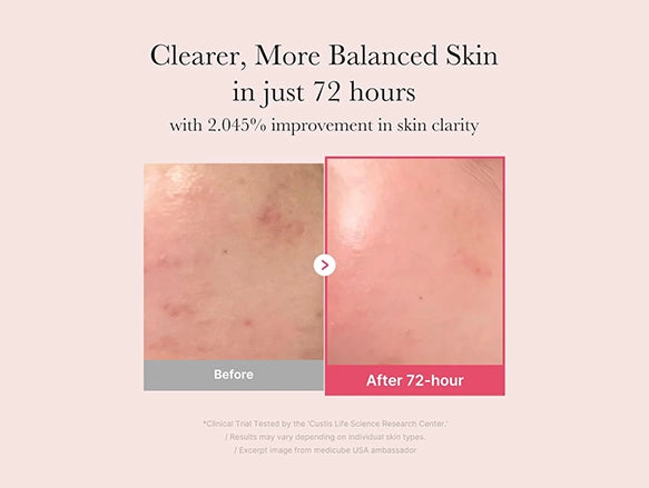 Medicube TXA Niacinamide 15 Serum 15% 30g in Sri Lanka