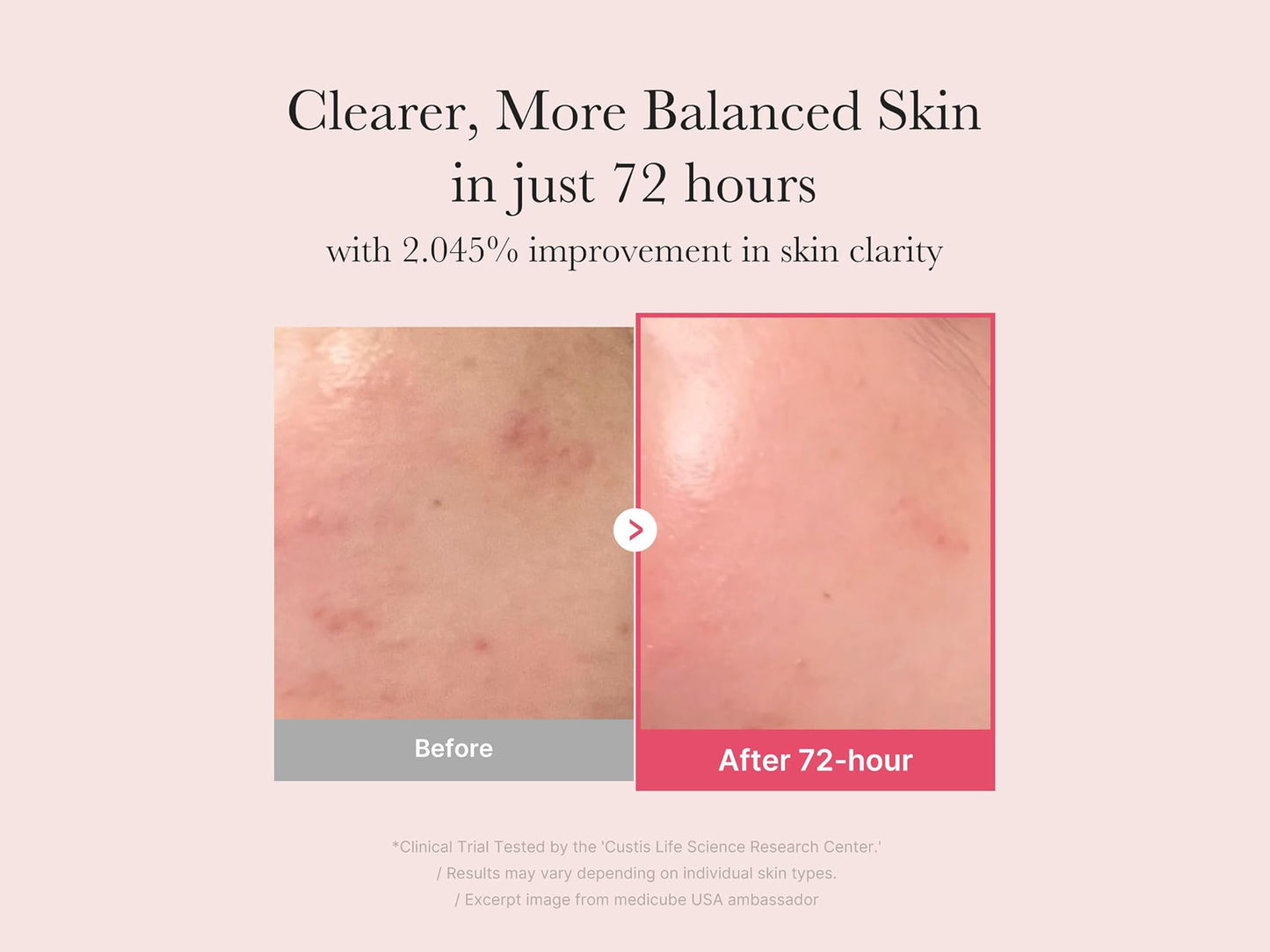 Medicube TXA Niacinamide 15 Serum 30ml in Sri Lanka