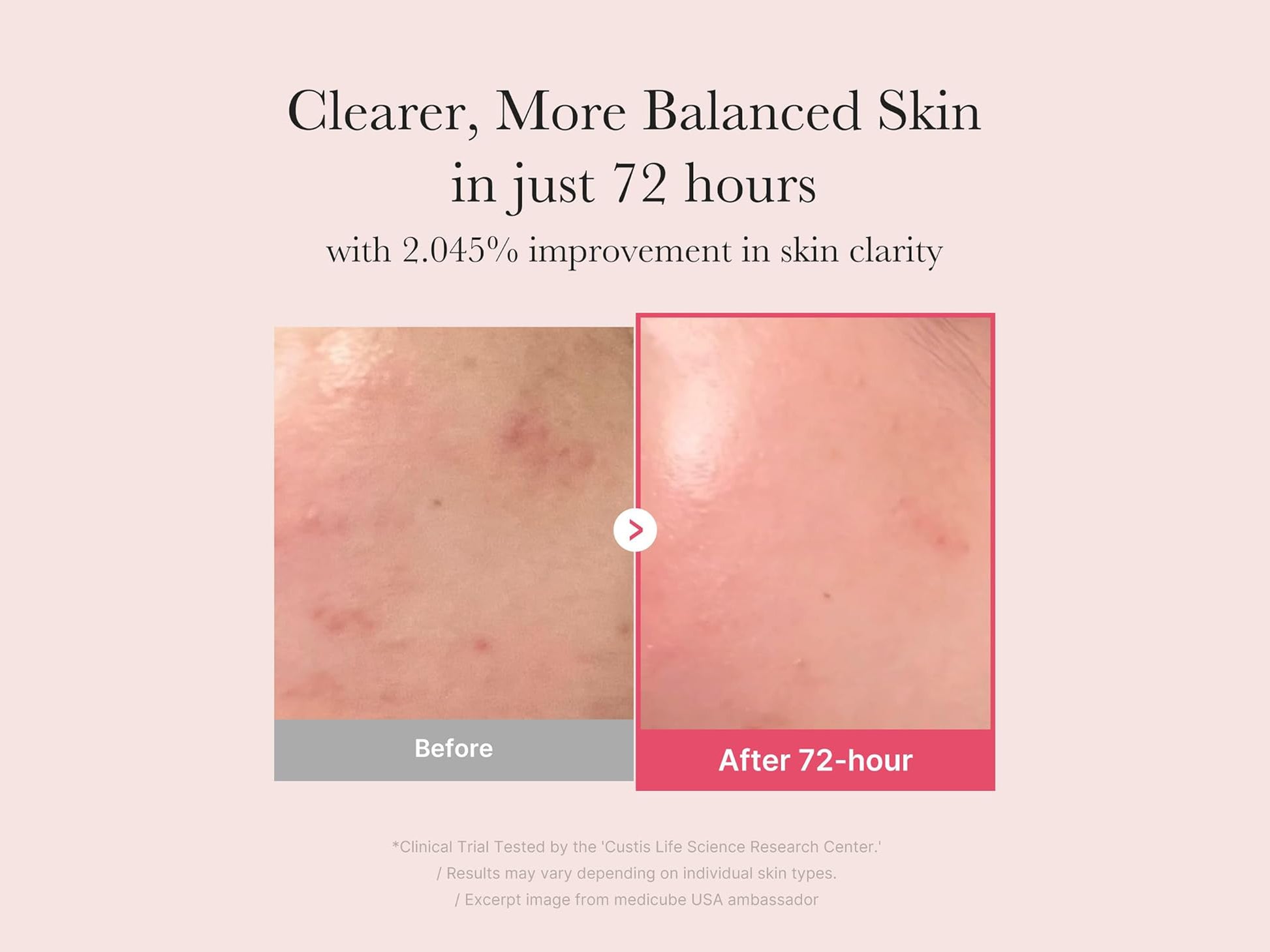 Medicube TXA Niacinamide 15 Serum 30ml in Sri Lanka