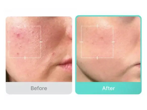 Medicube Azelaic Acid 16BB Calming Serum 30ml in Sri Lanka