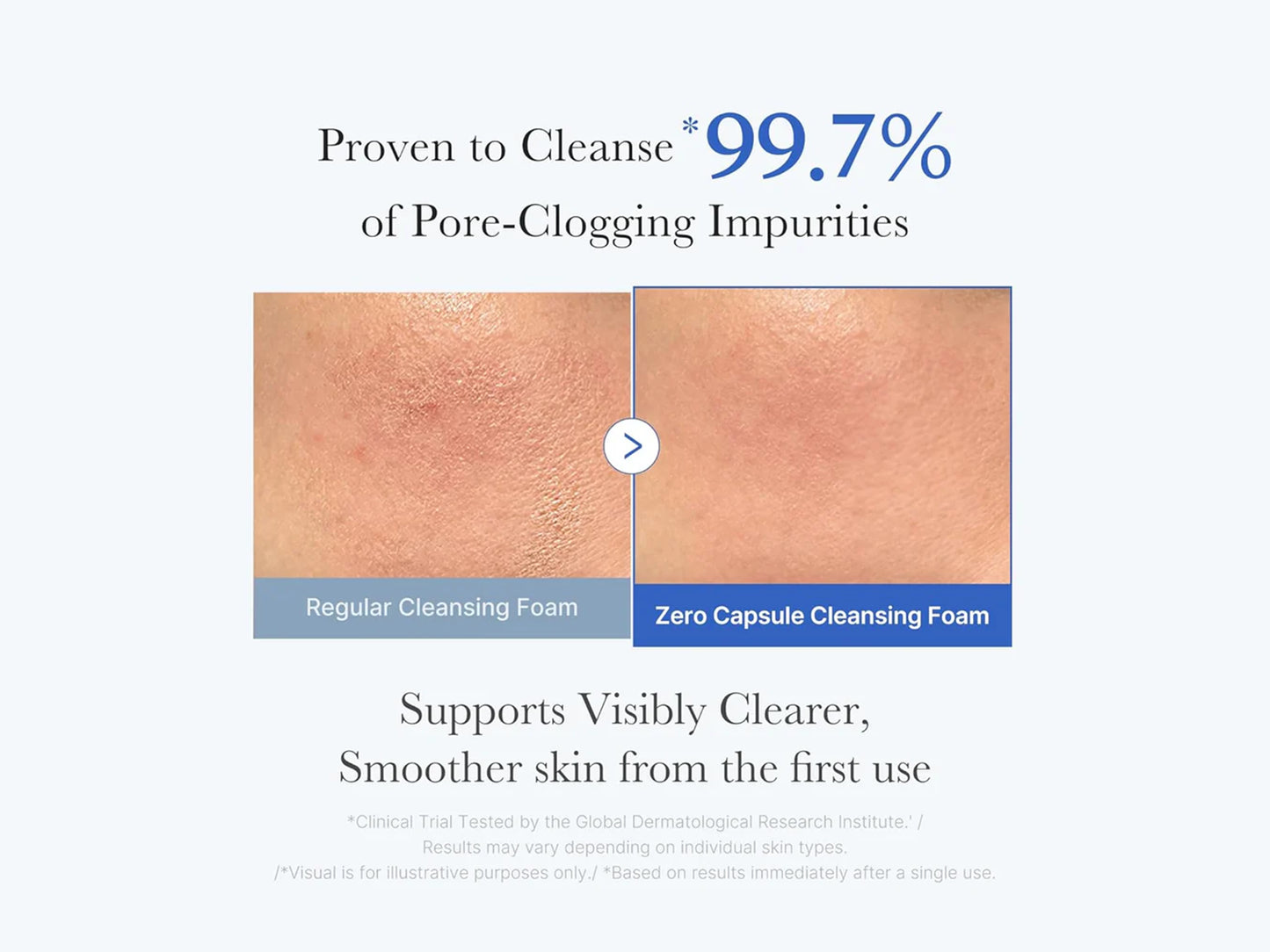 Medicube Zero Pore SA Clear Capsule Cleansing Foam 120g