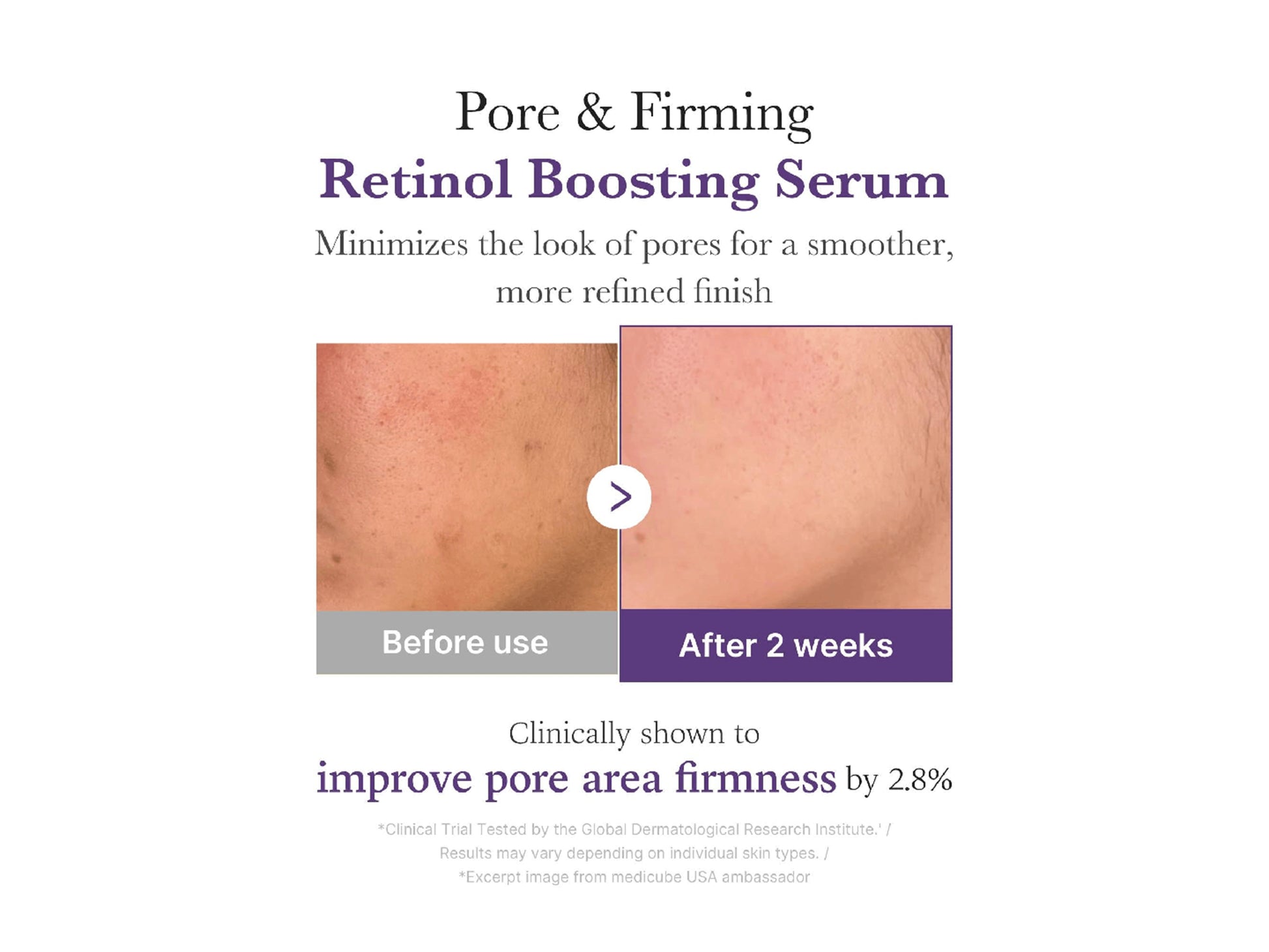 Medicube Retinol NMN Boosting Serum 30ml in Sri Lanka