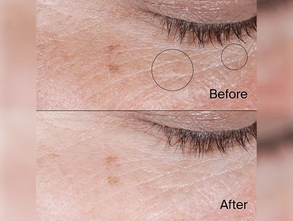 Neutrogena Collagen Bank Reviving Eye Gel Cream 14g