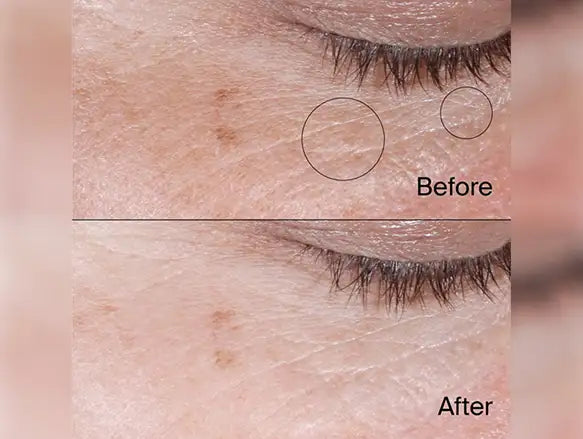 Neutrogena Collagen Bank Reviving Eye Gel Cream 15g in Sri Lanka