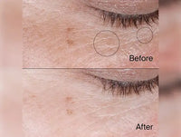 Neutrogena Collagen Bank Reviving Eye Gel Cream 15g in Sri Lanka