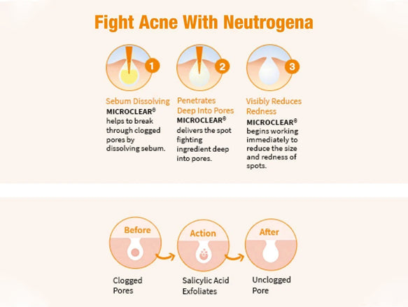 Neutrogena Oil-Free Acne Wash 177ml - KOREA - 9300607379792 in Sri Lanka