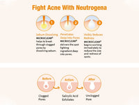 Neutrogena Oil-Free Acne Wash 177ml - KOREA - 9300607379792 in Sri Lanka