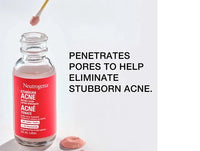 Neutrogena Stubborn Acne Spot Drying Lotion 29ml in Sri Lanka