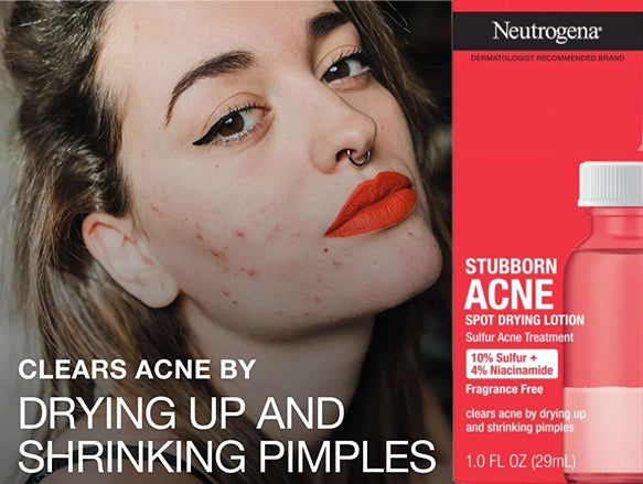 Neutrogena Stubborn Acne Spot Drying Lotion 29ml in Sri Lanka