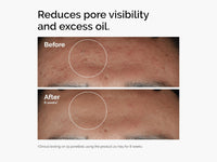 Buy Original THE ORDINARY Niacinamide 10% + ZINC 1% 60ml (CANADA) - CANADA in Sri Lanka
