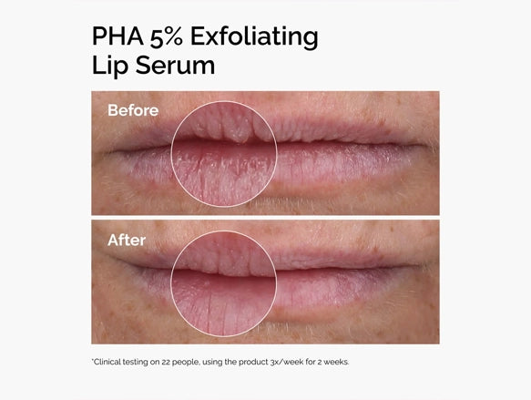 The Ordinary PHA 5% Exfoliating Lip Serum 15ml in Sri Lanka