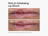 The Ordinary PHA 5% Exfoliating Lip Serum 15ml in Sri Lanka