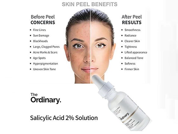 THE ORDINARY Salicylic Acid 2% Solution 30ml - CANADA - 769915199581 in Sri Lanka