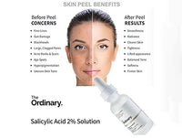 THE ORDINARY Salicylic Acid 2% Solution 30ml - CANADA - 769915199581 in Sri Lanka