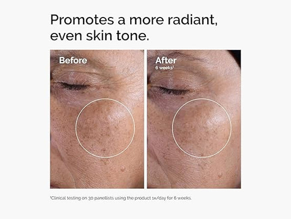 The Ordinary Glycolic Acid 7% Exfoliating Toner Daily AHA Toner to Improve Skin Texture, Tone & Luminosity 240ml in Sri Lanka