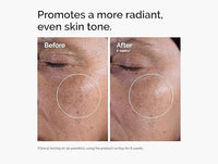 The Ordinary Glycolic Acid 7% Exfoliating Toner Daily AHA Toner to Improve Skin Texture, Tone & Luminosity 240ml in Sri Lanka